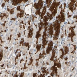TAK1 Antibody, Novus Biologicals 0.1mL; Unlabeled:Antibodies, Polyclonal